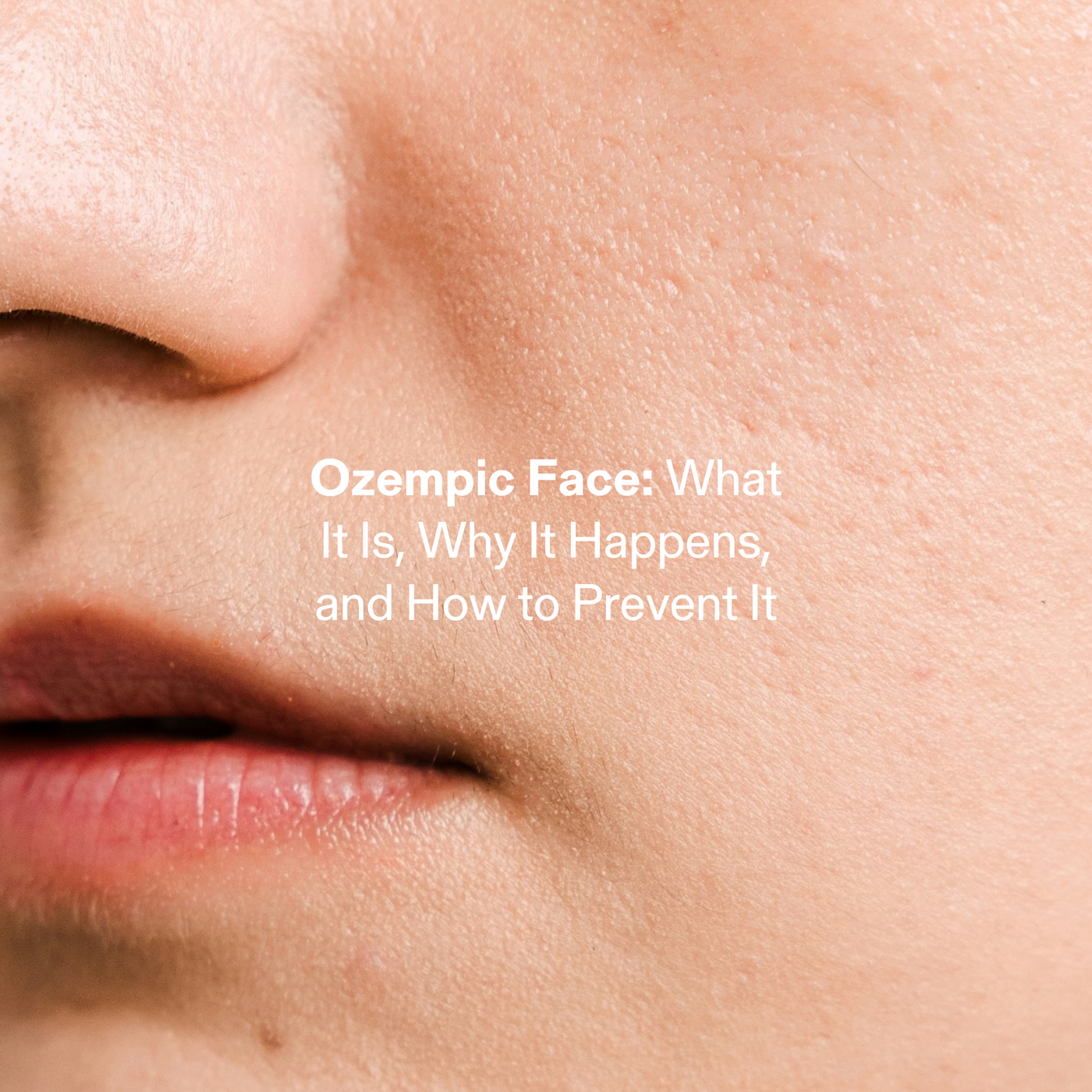 Ozempic Face: What It Is, Why It Happens, and How to Prevent It
